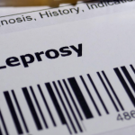 No Divorce on the Ground of Leprosy
